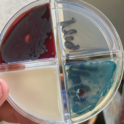 Dairy farms see unexpected rise in Serratia mastitis