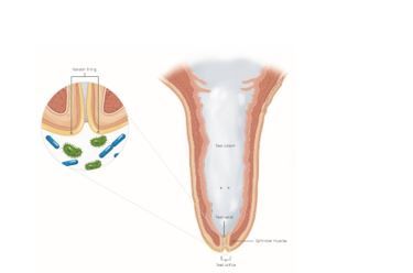 Why is teat condition so critical?